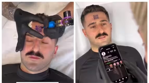 QR code tattooed on forehead