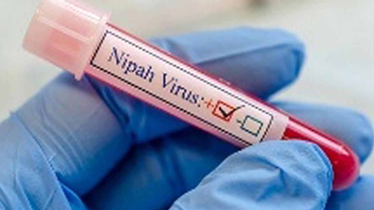IMG_BL13_Nipah_2_1_I1BO858L