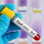 IMG_BL29_Nipah_2_1_1HCRSTV9 (1)